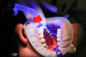 dentures